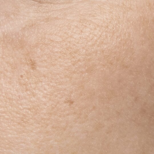 close-up-face-pores-texture